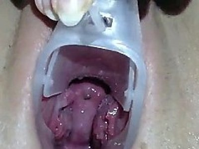 Teen exploring cervix & deep vagina with speculum